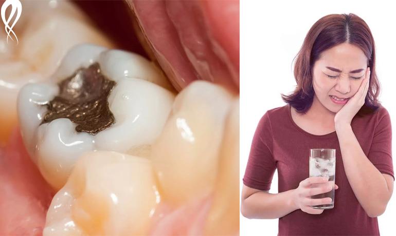 دلیل حساسیت دندان بعد از پرکردن و ترمیم چیست؟